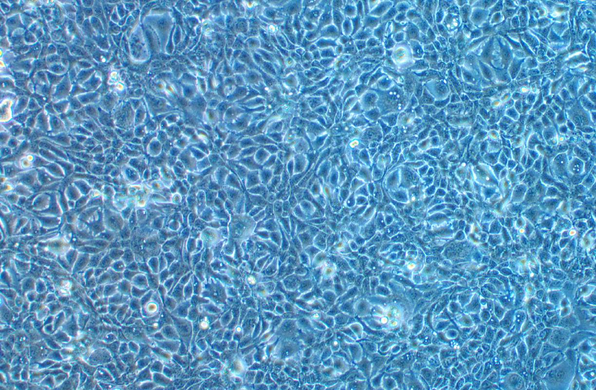 人膀胱癌細胞HT-1376(STR鑒定正確)