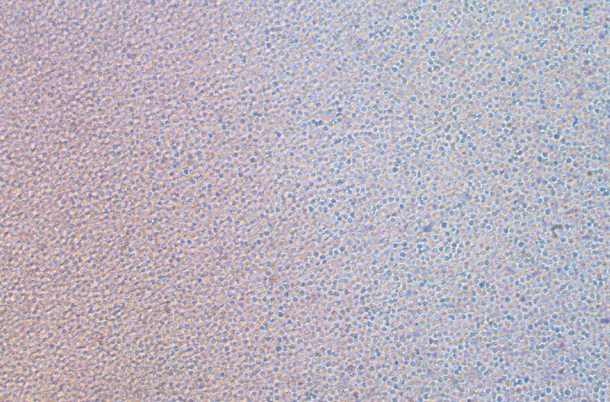 人原髓細(xì)胞白血病細(xì)胞帶熒光素酶HL-60+LUC(STR鑒定正確)