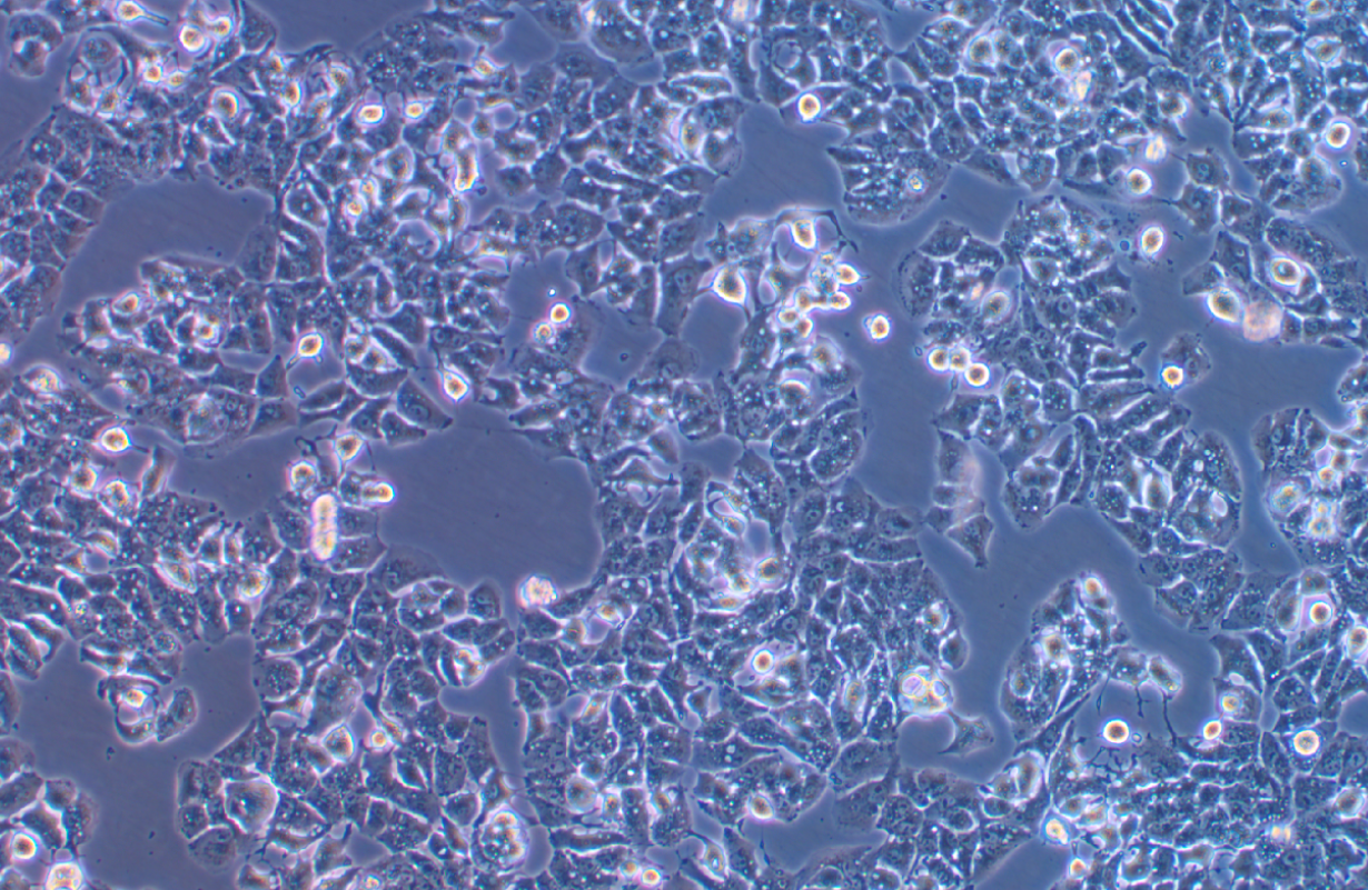 低轉移人肝癌細胞MHCC97-L(STR鑒定正確)