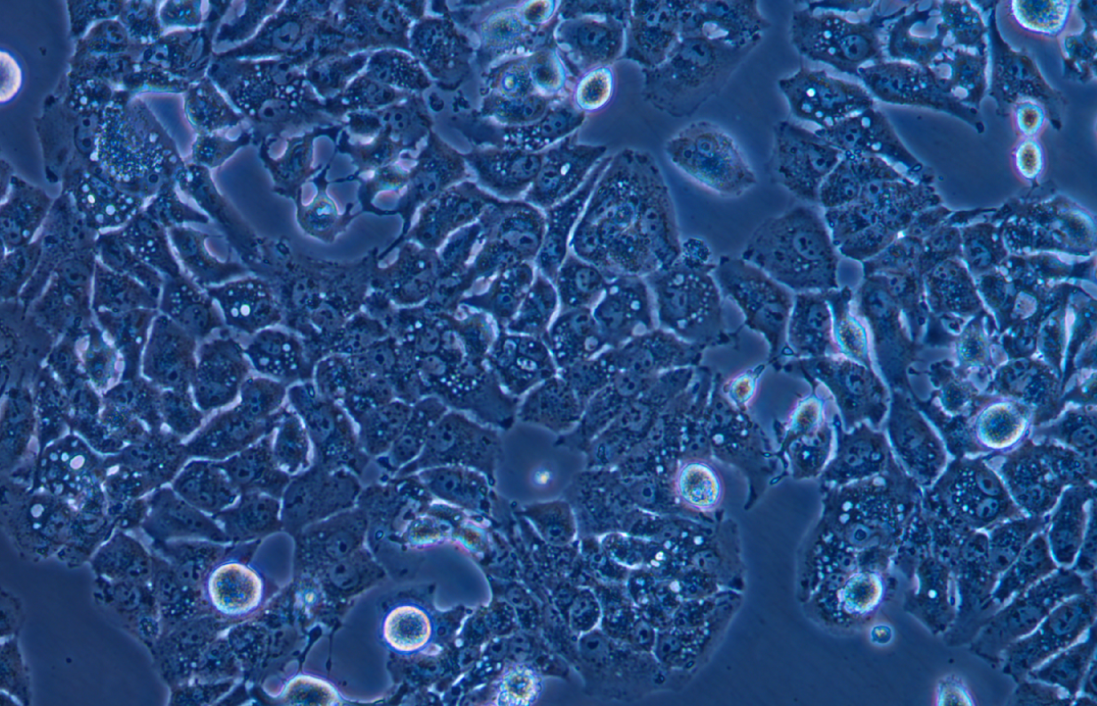低轉移人肝癌細胞MHCC97-L(STR鑒定正確)