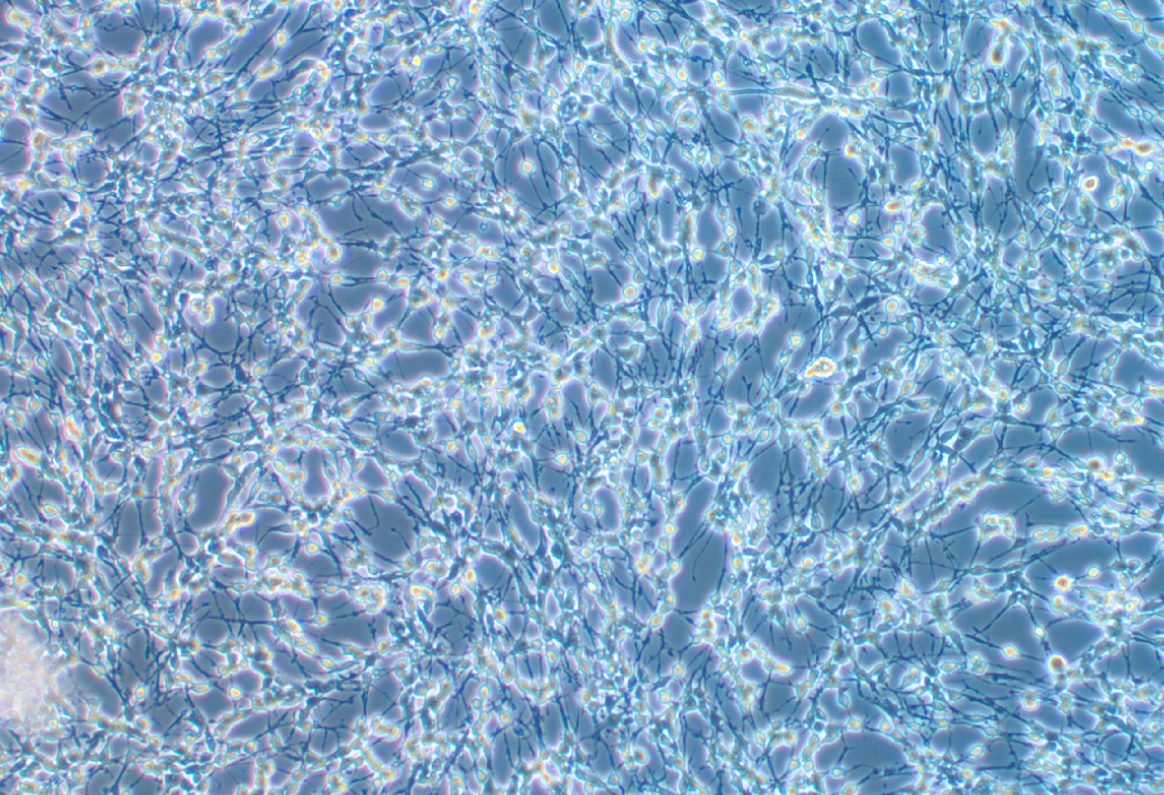 大鼠腎上腺嗜鉻細胞瘤細胞(高分化)PC-12(高分化)(種屬鑒定)