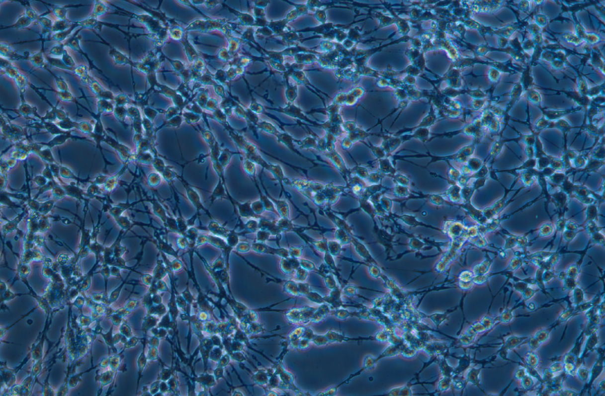 大鼠腎上腺嗜鉻細胞瘤細胞(高分化)PC-12(高分化)(種屬鑒定)