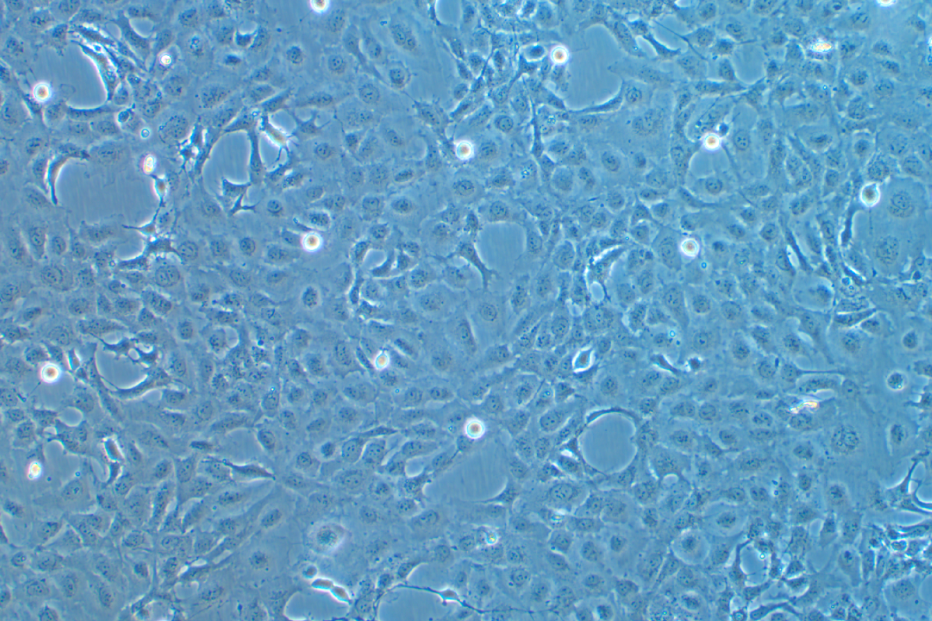 人肝星形細胞LX-2 (STR鑒定正確)