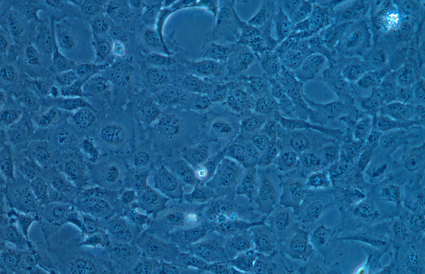 人肝星形細胞LX-2 (STR鑒定正確)