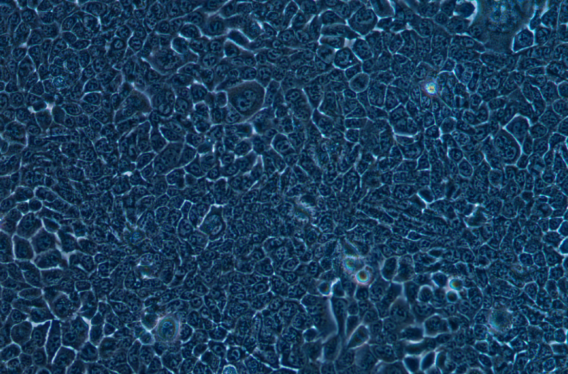 小鼠口腔鱗狀細(xì)胞癌細(xì)胞MOC1(STR鑒定正確)