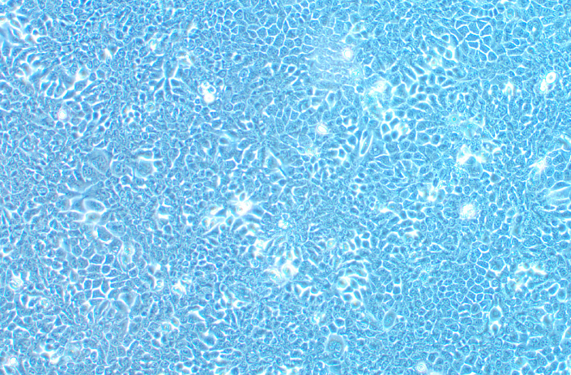 小鼠口腔鱗狀細(xì)胞癌細(xì)胞MOC1(STR鑒定正確)