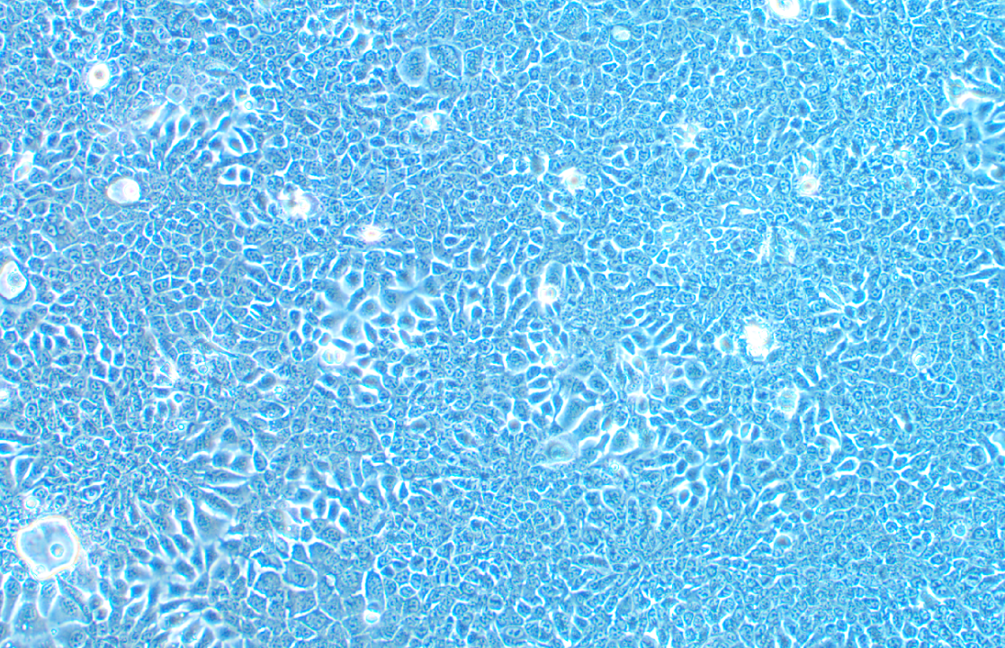 小鼠口腔鱗狀細(xì)胞癌細(xì)胞MOC1(STR鑒定正確)