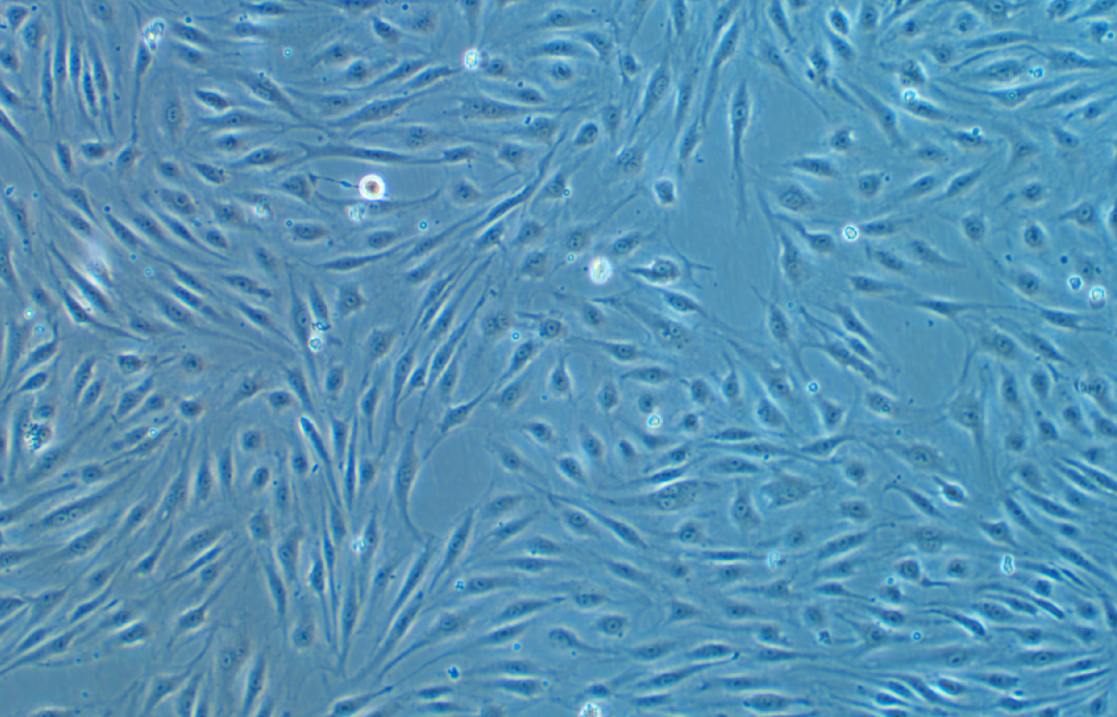 人原代肺微血管內皮細胞