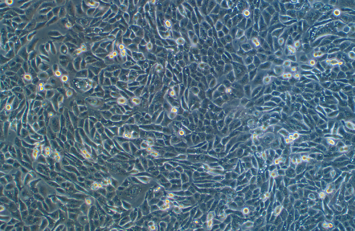 人鼻咽癌細胞NPC/HK1(STR鑒定正確)