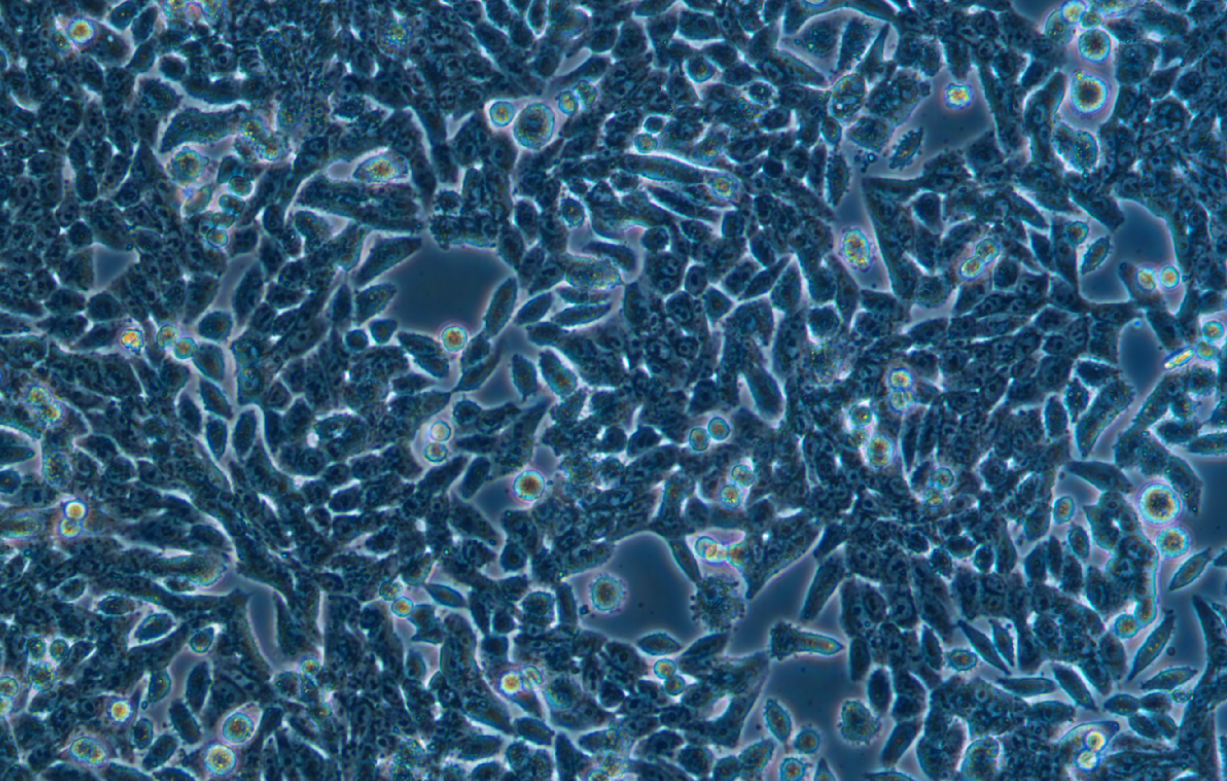 人結腸癌細胞SW620 (STR鑒定正確)