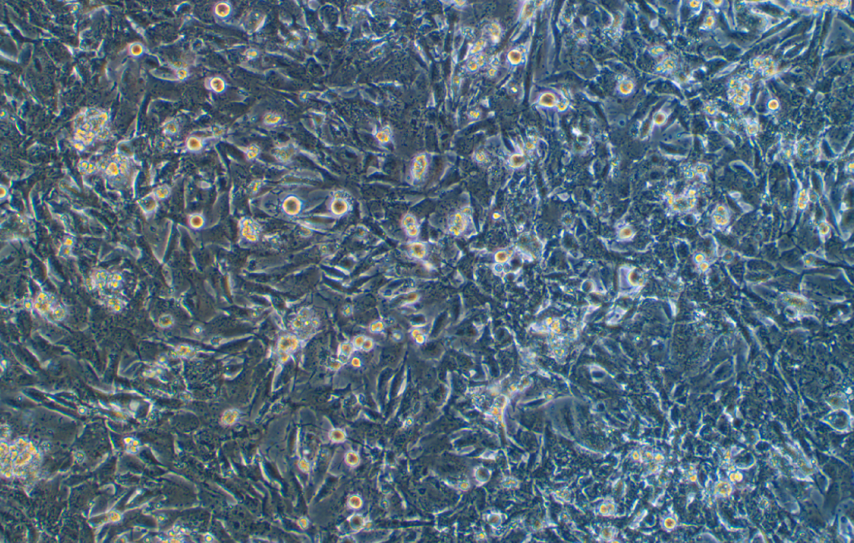 小鼠膠質(zhì)瘤細胞GL261(種屬鑒定)