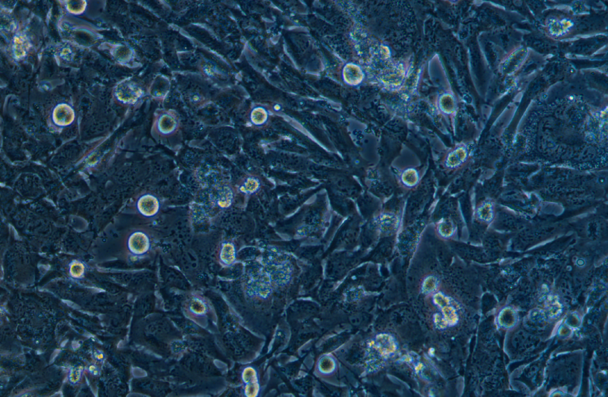 小鼠膠質(zhì)瘤細胞GL261(種屬鑒定)