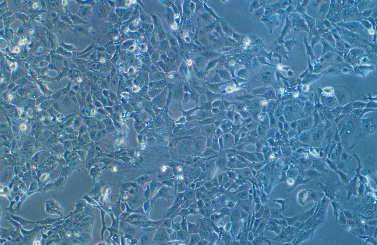 (小鼠心肌細胞)HL-1(STR鑒定正確)
