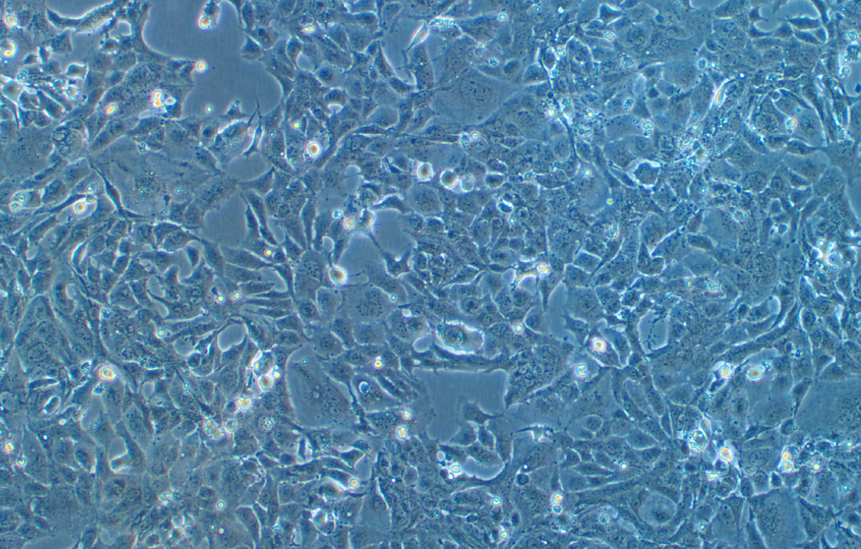 (小鼠心肌細胞)HL-1(STR鑒定正確)