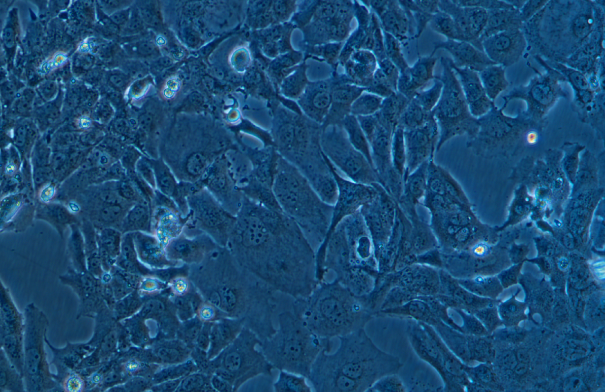 (小鼠心肌細胞)HL-1(STR鑒定正確)