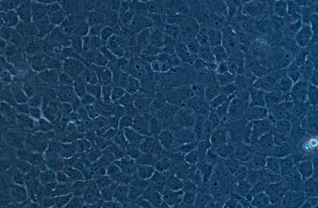 人晶體上皮細胞SRA01/04(STR鑒定正確)