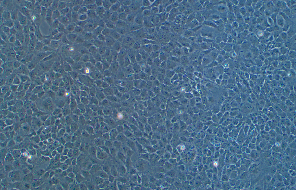 人晶體上皮細胞SRA01/04(STR鑒定正確)