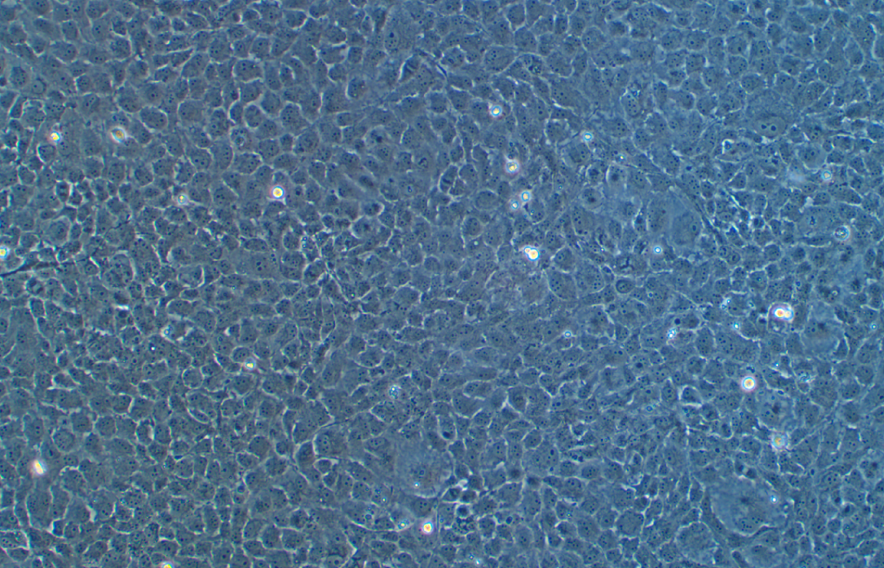 人晶體上皮細胞SRA01/04(STR鑒定正確)