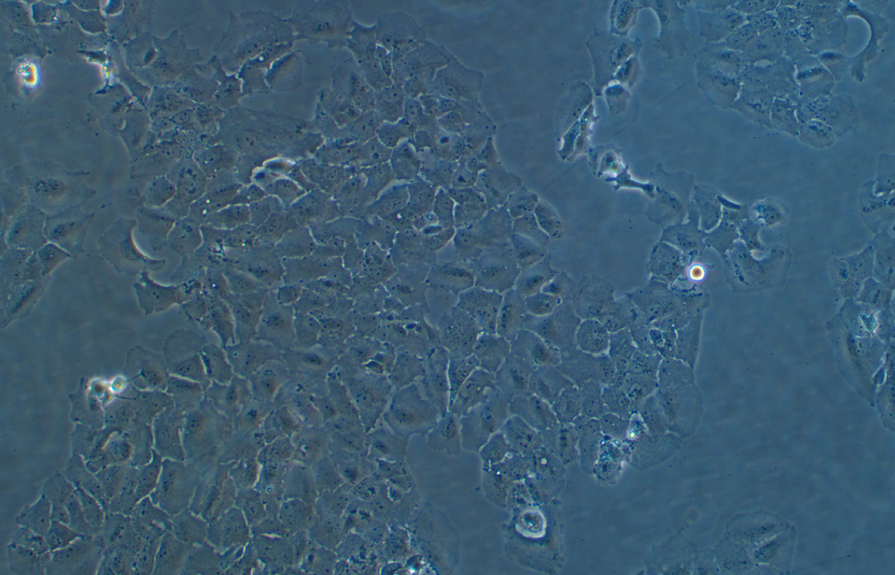 人卵巢癌細胞Caov3(STR鑒定正確)