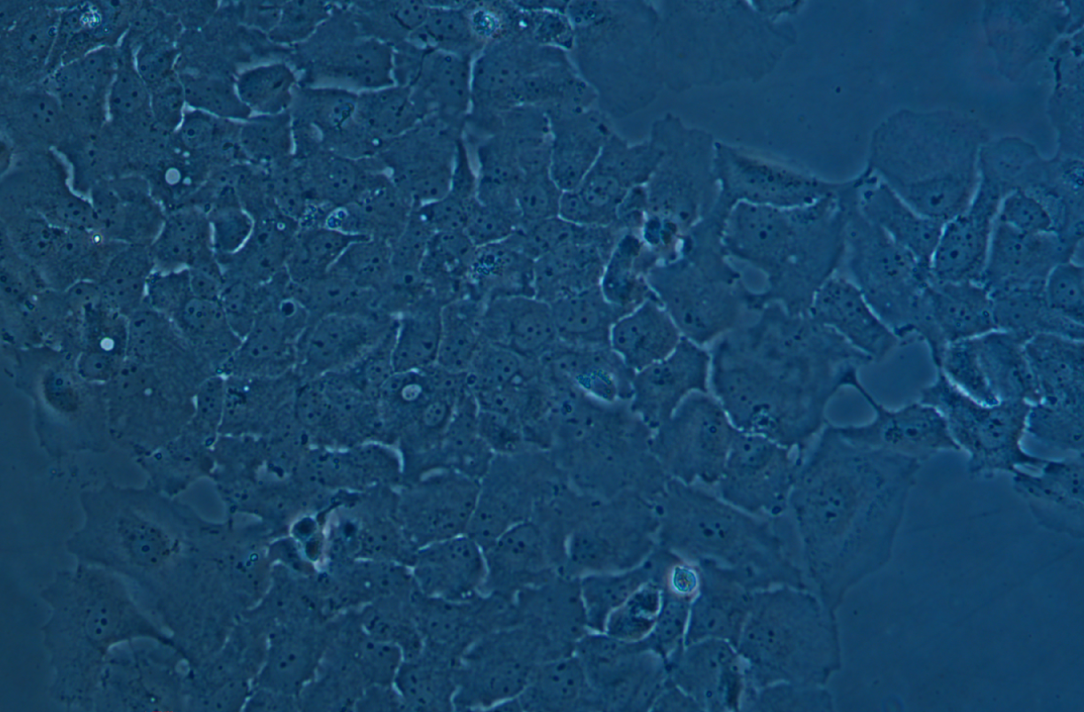 人卵巢癌細胞Caov3(STR鑒定正確)