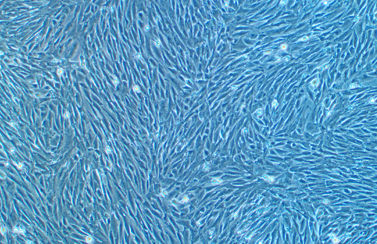 鴨子胚胎成纖維細(xì)胞 Duckembryo(種屬鑒定)