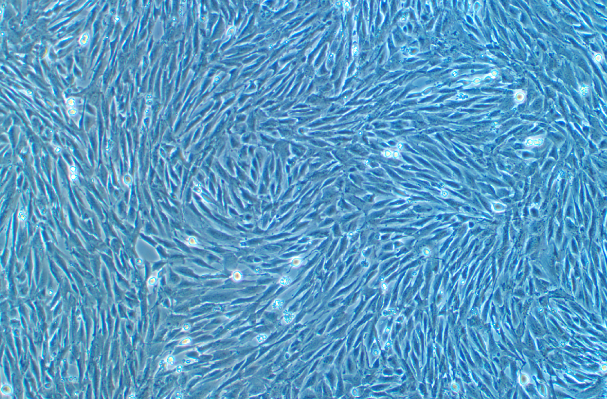 鴨子胚胎成纖維細(xì)胞 Duckembryo(種屬鑒定)