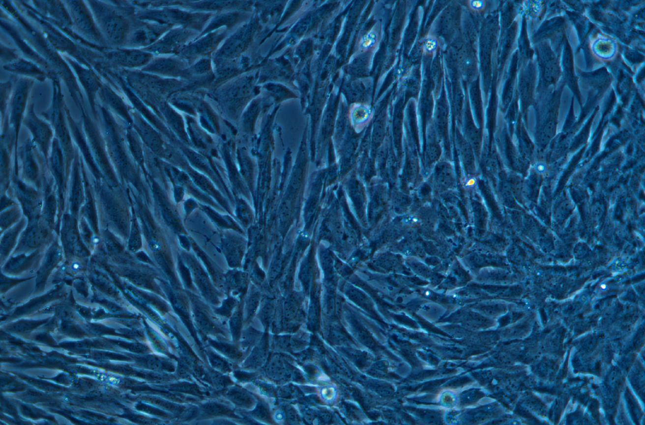 鴨子胚胎成纖維細(xì)胞 Duckembryo(種屬鑒定)