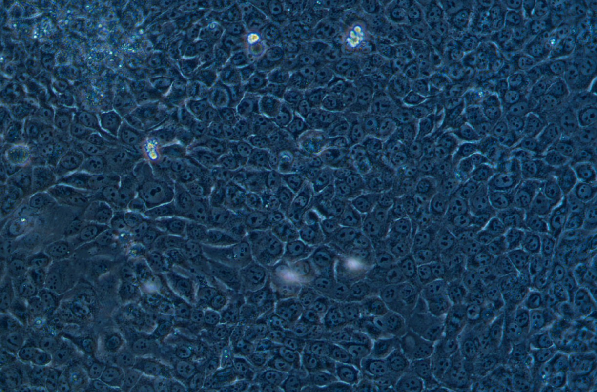 人舌鱗狀癌細胞SAS(STR鑒定正確)