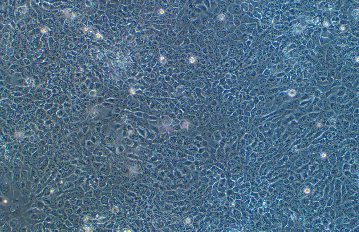 人舌鱗狀癌細胞SAS(STR鑒定正確)