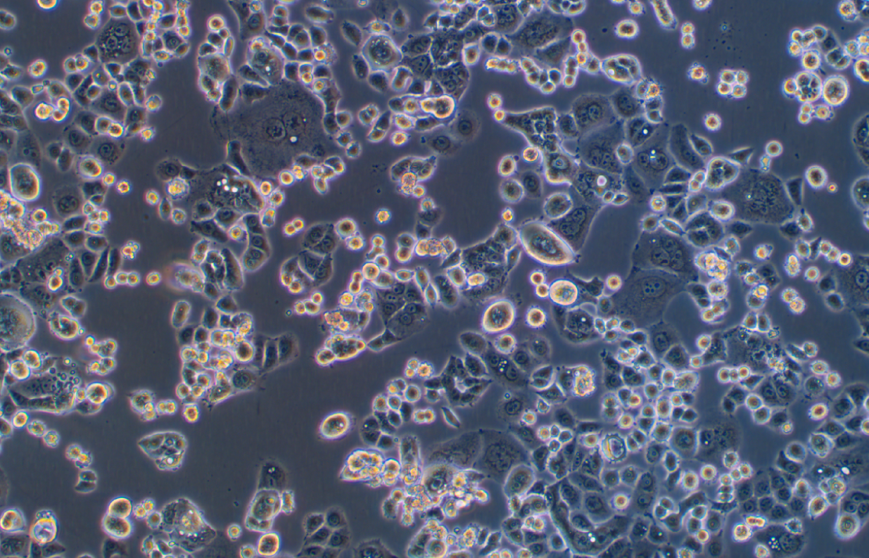 人胃癌細胞GCIY(STR鑒定正確)