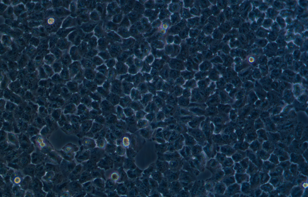 人胃癌順鉑耐藥株SGC7901/DDP(STR鑒定正確)