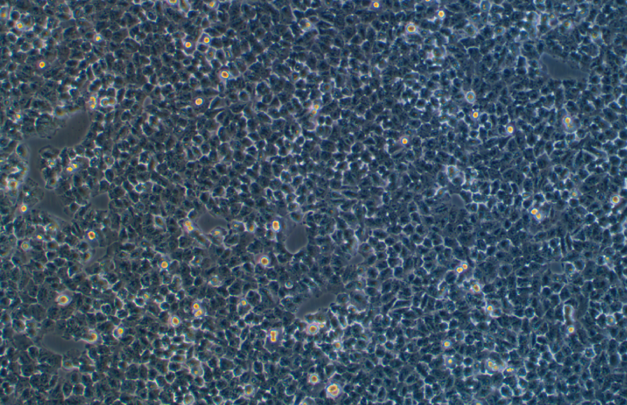 人胃癌順鉑耐藥株SGC7901/DDP(STR鑒定正確)