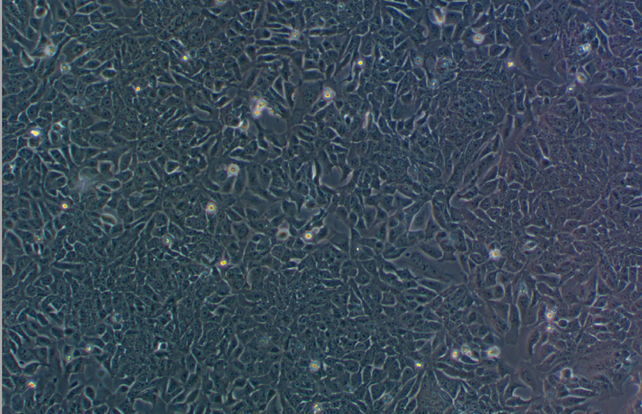 人結(jié)直腸腺癌上皮細胞DLD-1(STR鑒定正確)