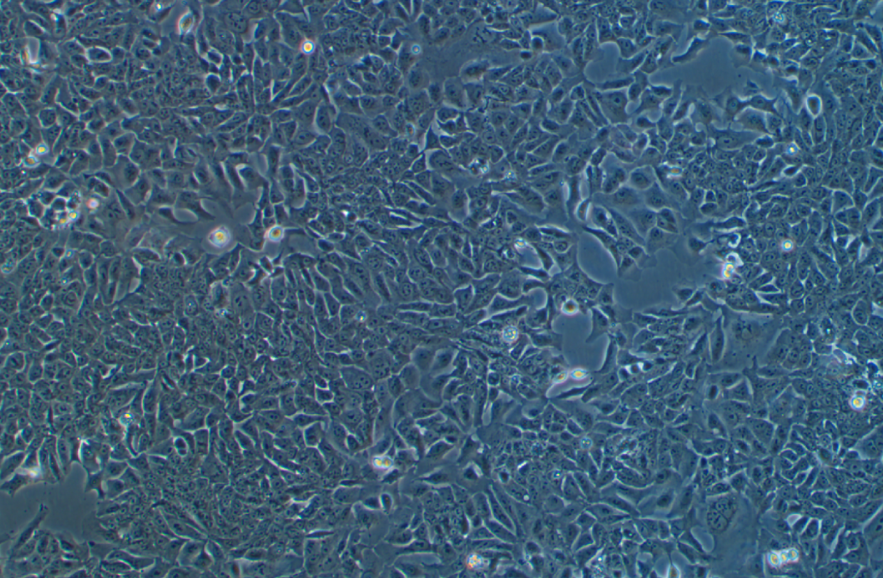 人結(jié)直腸腺癌上皮細胞DLD-1(STR鑒定正確)