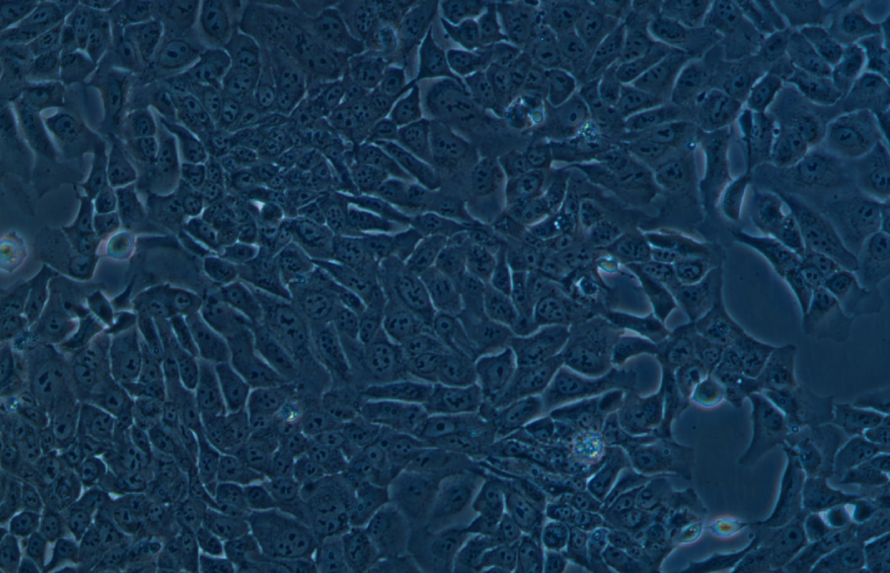 人結(jié)直腸腺癌上皮細胞DLD-1(STR鑒定正確)