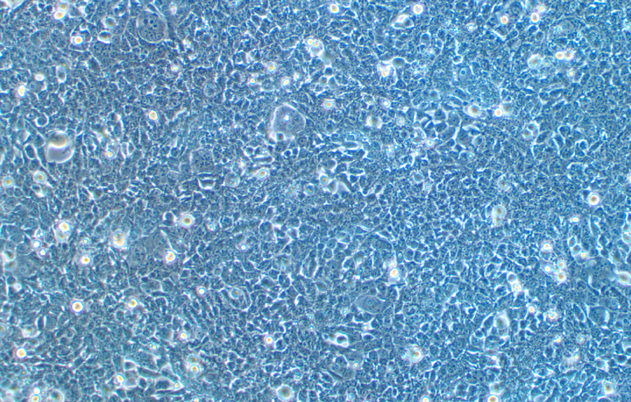 表達SV40T抗原人胚腎上皮細胞293FT(STR鑒定正確)