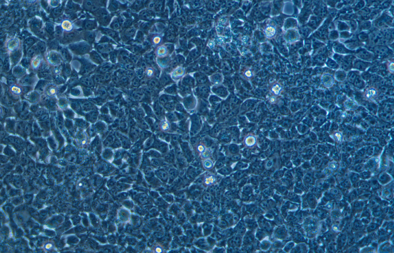 表達SV40T抗原人胚腎上皮細胞293FT(STR鑒定正確)