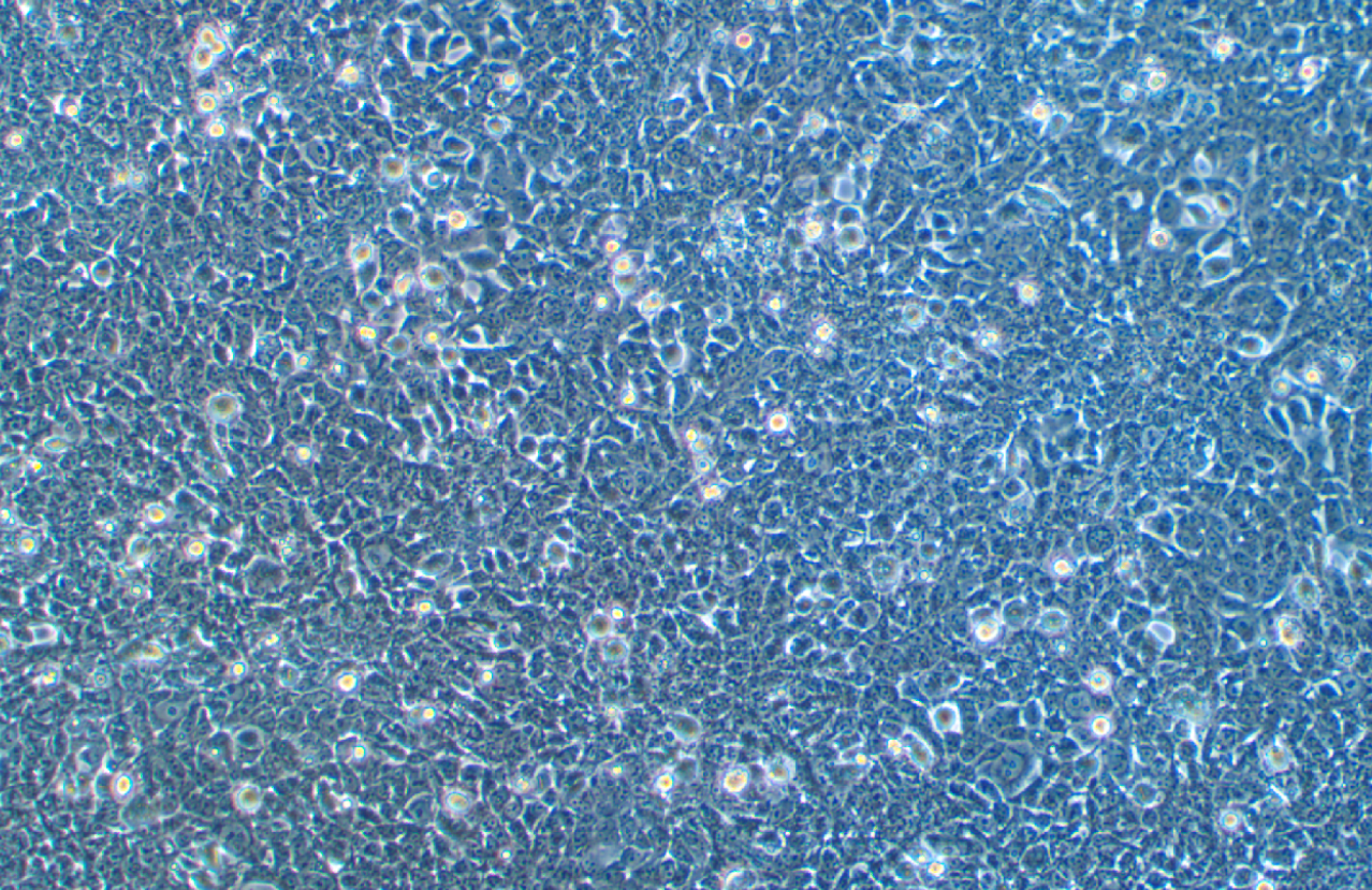 表達SV40T抗原人胚腎上皮細胞293FT(STR鑒定正確)