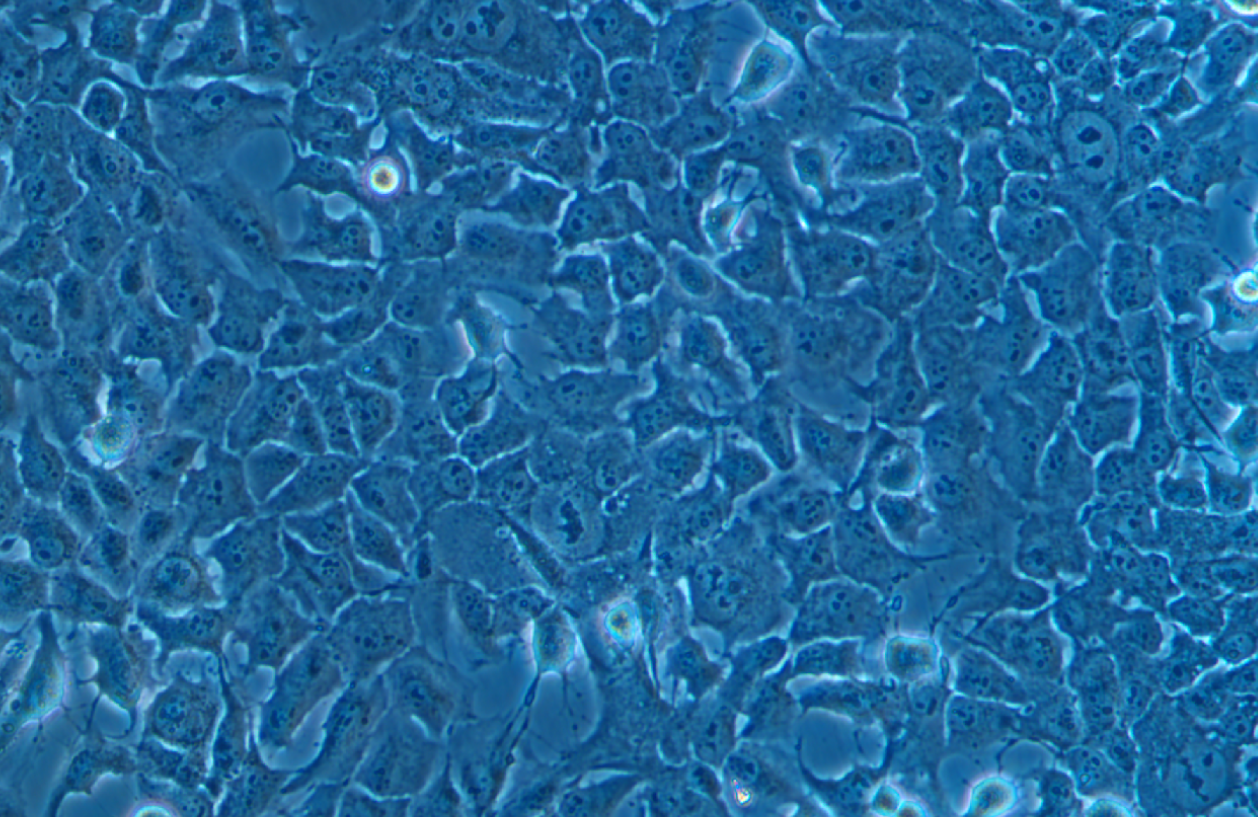 人肺腺癌細胞NCI-H1975(STR鑒定正確)