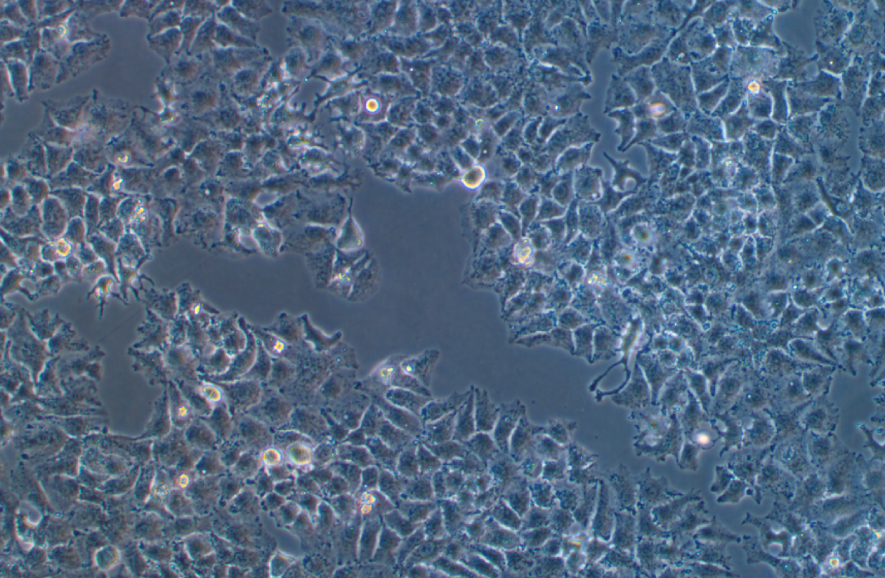 人肝癌細(xì)胞 Huh7.5.1(STR鑒定正確)