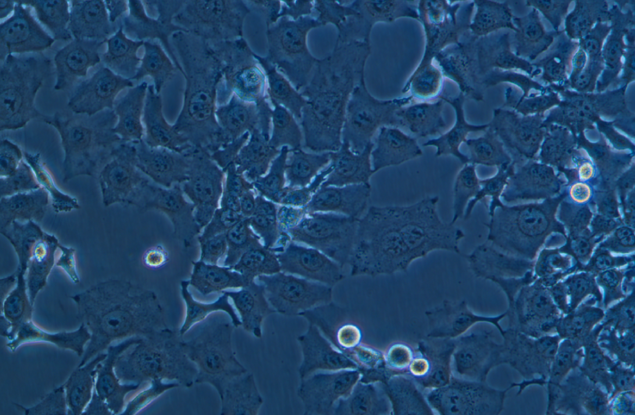 人肺鱗癌細(xì)胞HCC1588 (STR鑒定正確)