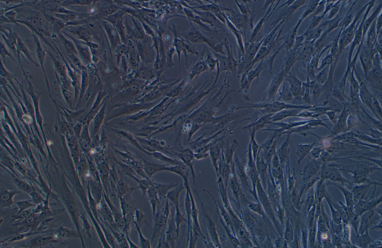 人肺成纖維細胞HFL1(STR鑒定正確)