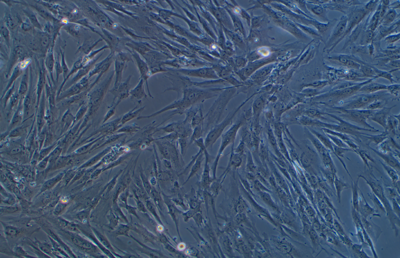 人肺成纖維細胞HFL1(STR鑒定正確)