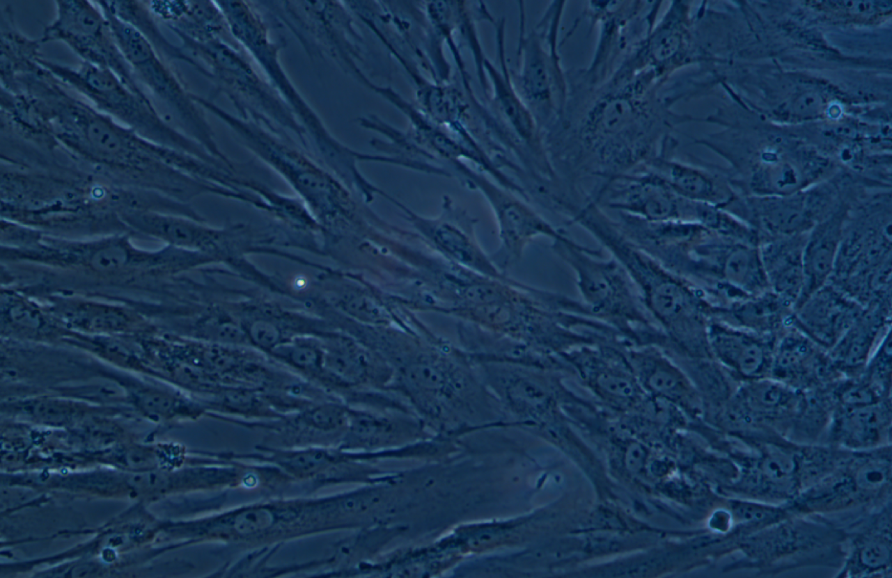 人肺成纖維細胞HFL1(STR鑒定正確)