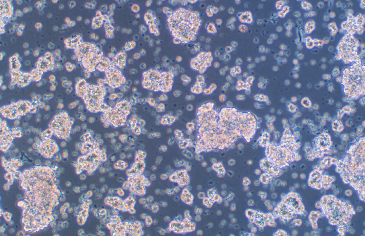 小鼠垂體瘤細(xì)胞AtT-20(種屬鑒定)