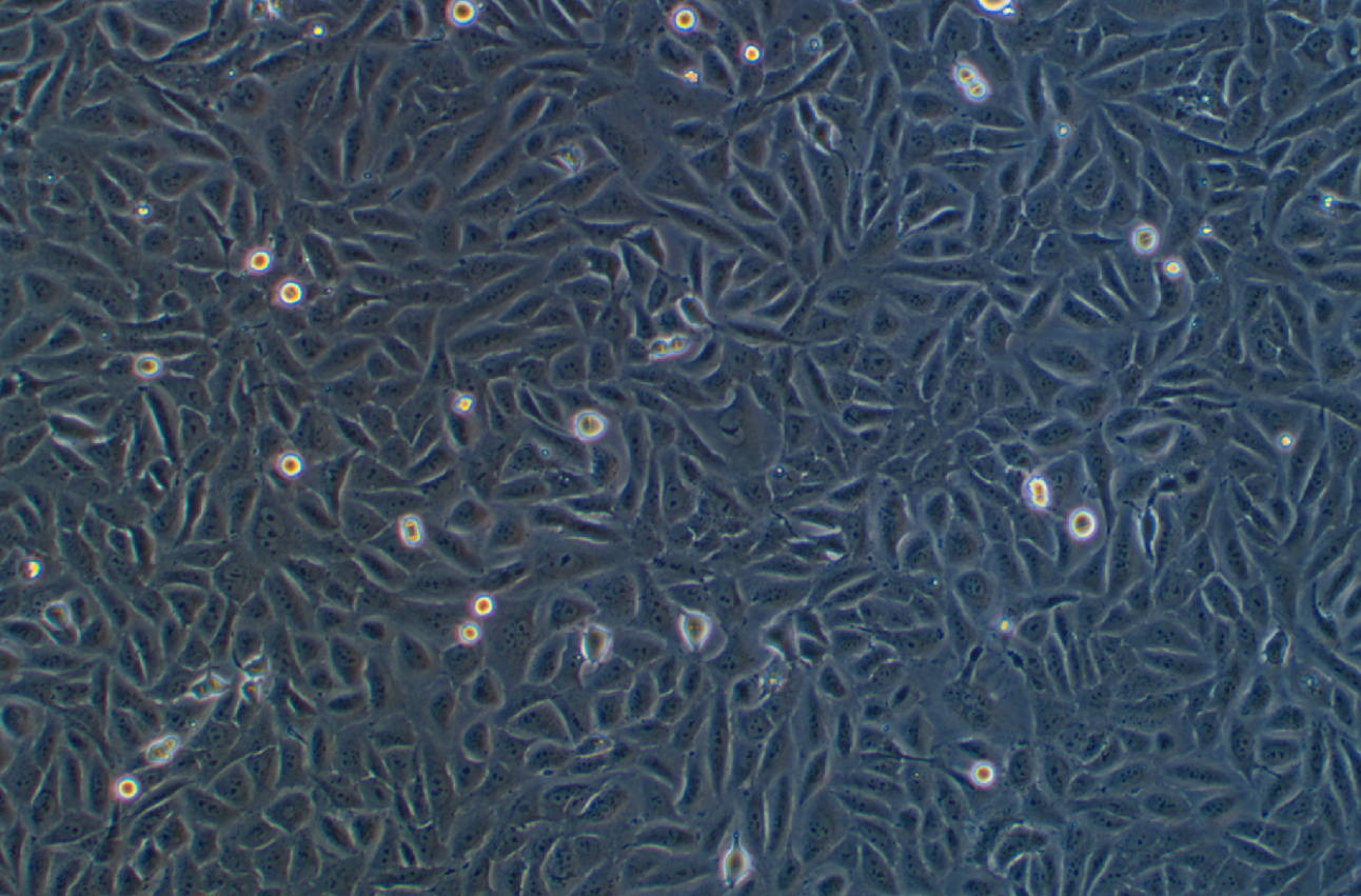 人骨肉瘤細胞HOS(STR鑒定正確)