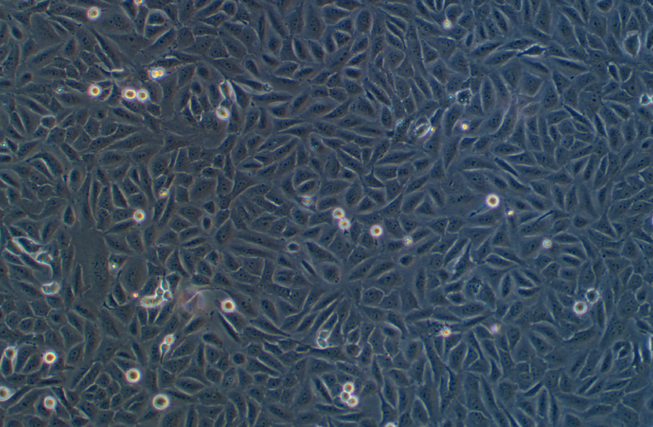 人骨肉瘤細胞HOS(STR鑒定正確)
