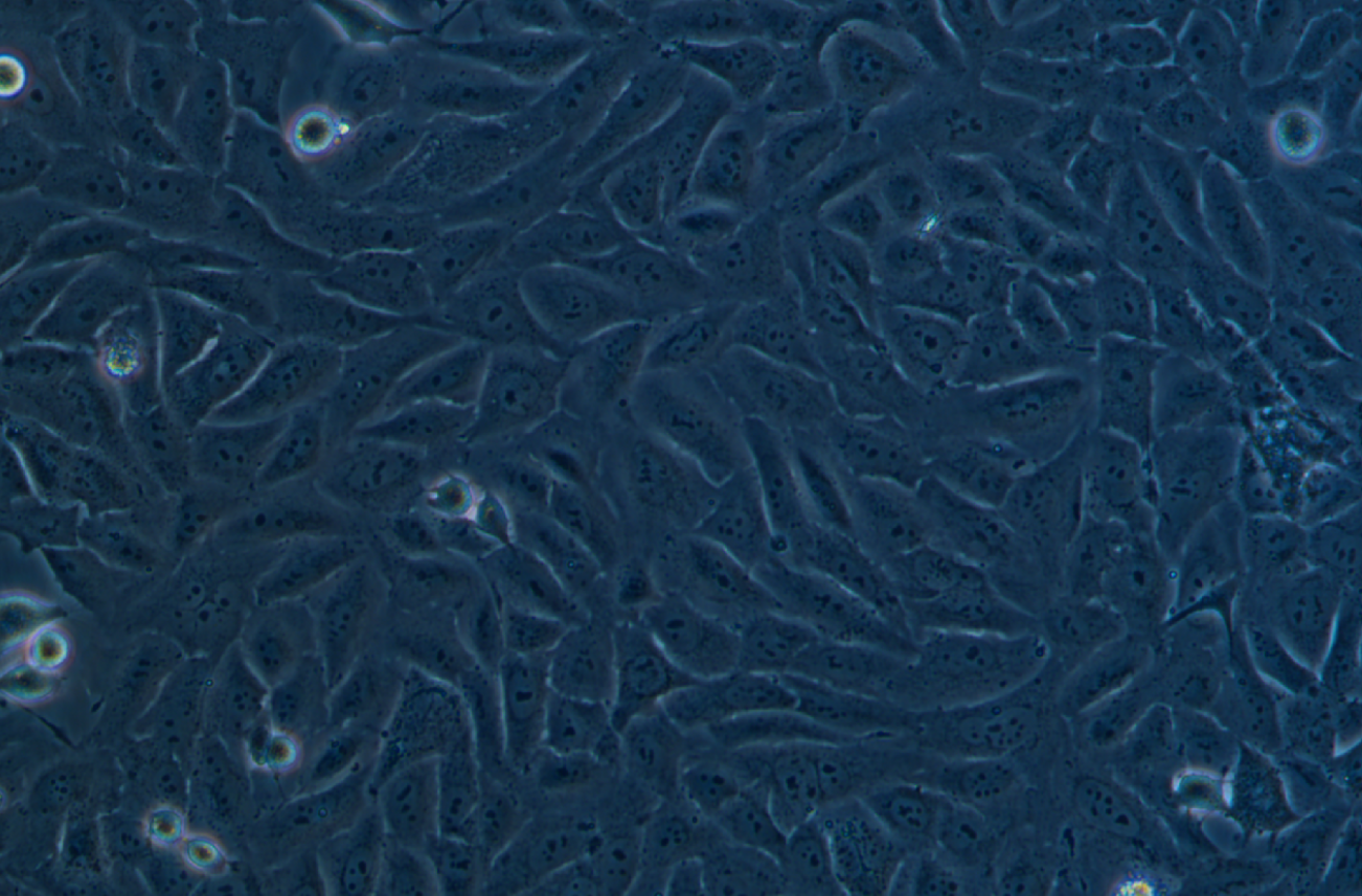 人骨肉瘤細胞HOS(STR鑒定正確)