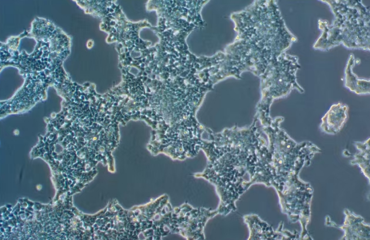 人小細胞肺癌 NCI-H2227(STR鑒定正確)