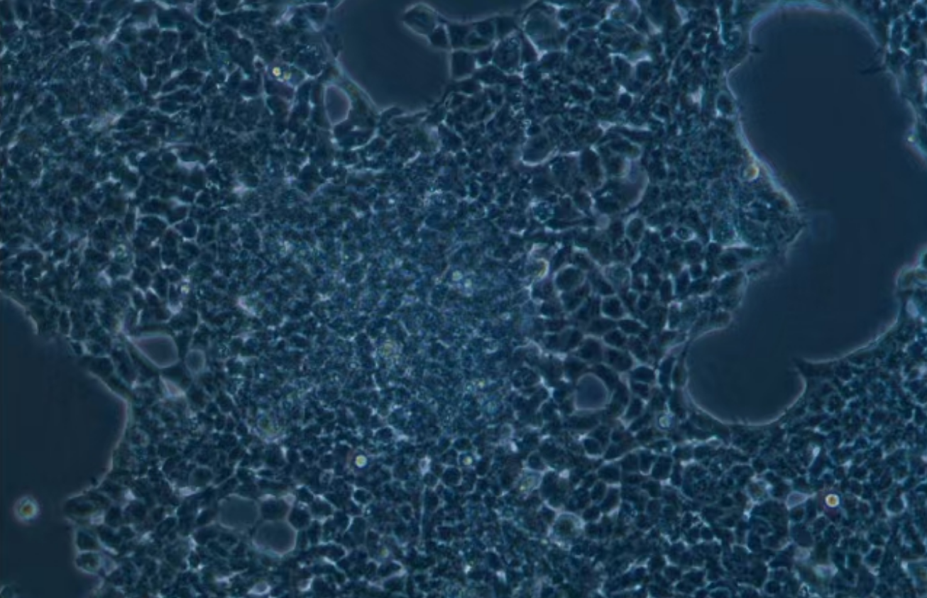 人小細胞肺癌 NCI-H2227(STR鑒定正確)